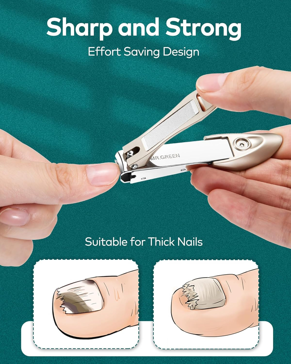 MR.GREEN Nagelknipser 2Er-Set, Anti-Splash Nagelknipser Mit Catcher, German Premium Edelstahl Nagelknipser, Scharfe Langlebige Nagelknipser Für Alle Altersgruppen, Männer, Frauen, Babys, Senioren